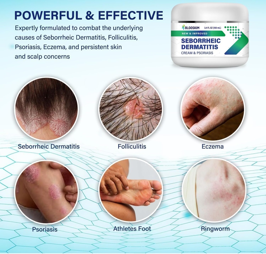 seborrheic-dermatitis-face-cream-face-sc-2.jpg