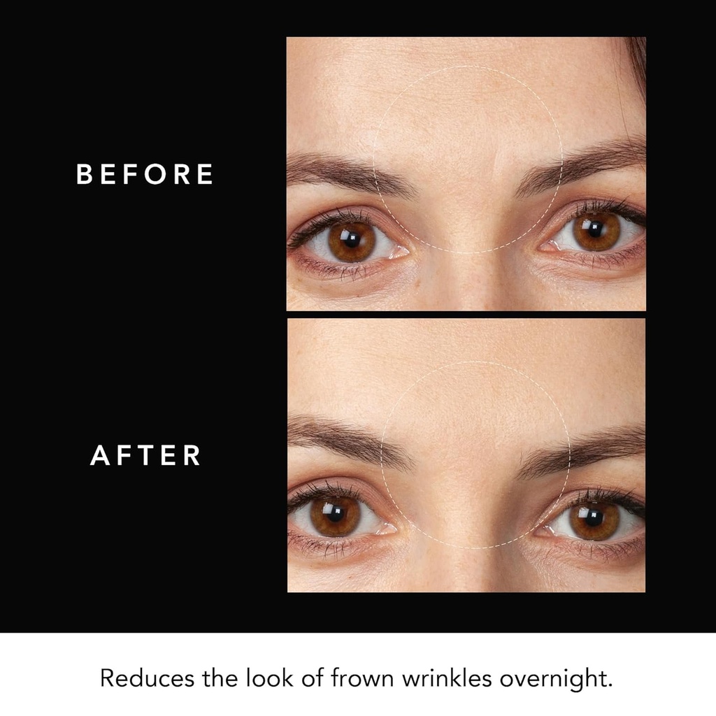 faq-hyaluronic-acid-patches-for-forehead-5.jpg