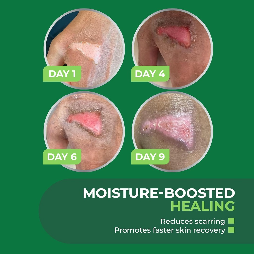 turfguard-hydrogel-turf-burn-dressing-wi-6.jpg
