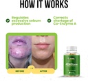 acnetane---all-natural-vitamin-supplemen-2.jpg