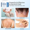 jock-itch-antifungal-cream-ringworm-trea-3.jpg