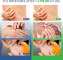 jock-itch-antifungal-cream-ringworm-trea-6.jpg