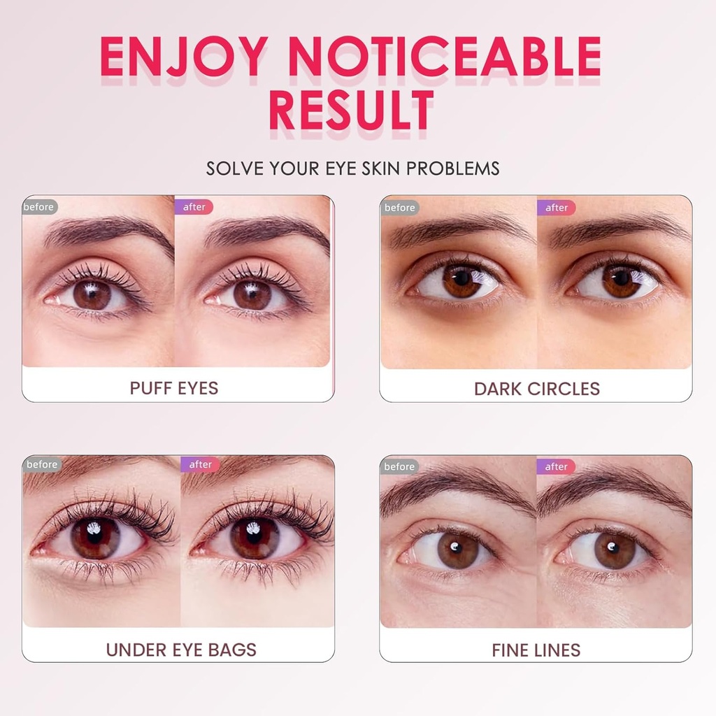 under-eye-patches-for-women---under-eye--4.jpg
