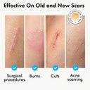 serica-scar-gel-1oz-advanced-silicone-fo-3.jpg