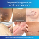 scaraway-advanced-clear-silicone-scar-sh-3.jpg