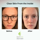 clear-skin-acne-vitamin-system-20-antiox-2.jpg