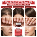 biotin-collagen-keratin-hair-vitamins-wo-3.jpg