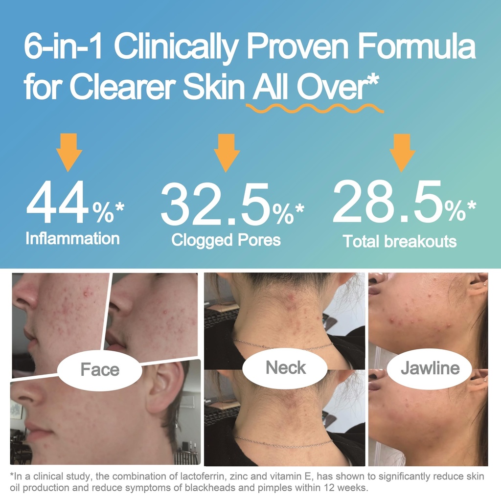 life-space-probiotics-for-women-skin-pro-3.jpg