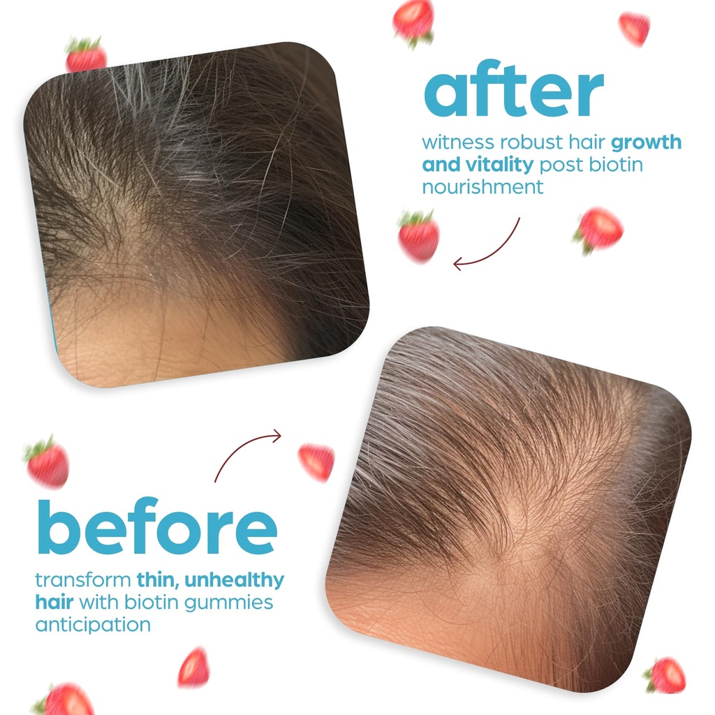 artnaturals-biotin-gummies-for-hair-grow-5.jpg