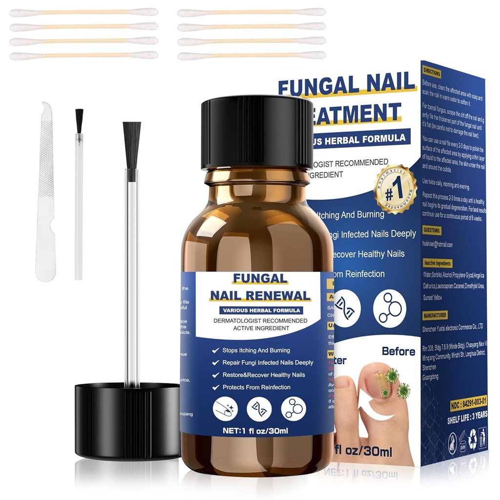 Teennagel Schimmel Behandeling,Foot Schimmel Behandeling Extra sterkte, Fungus Nail Behandeling, Toe Nagel Schimmel Behandelingen voor Schimmel Nagel gele teennagel behandeling(1fl oz/30ml)