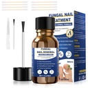 Teennagel Schimmel Behandeling,Foot Schimmel Behandeling Extra sterkte, Fungus Nail Behandeling, Toe Nagel Schimmel Behandelingen voor Schimmel Nagel gele teennagel behandeling(1fl oz/30ml)