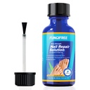 Teennagel Schimmelbehandeling Extra sterkte - Nagelschimmel behandeling voor teennagel - Teennagel Schimmelbehandeling Extra sterkte - Nagelschimmel behandeling (30 ml)
