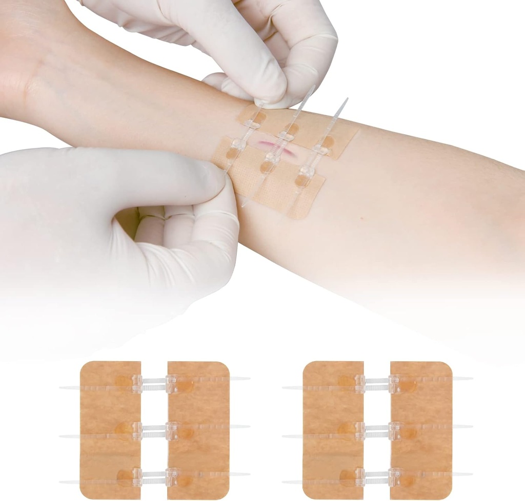 Réparez la lacération des points de fermeture avec les points sans les points Butterfly Bandaids Clot rapide - Serrures de plaie d'urgence Appareil 2 pièces(PU)