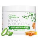 Wild Naturals Eczema & Psoriasis Cream for Dry, Itchy Skin 