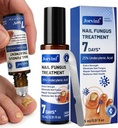 Toenail Fungus Treatment, 25% Undecylenic Acid Roll-On, 0.51 Fl Oz