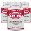 Acne pillen- Acne Tame 3 Pack Supplement- Heldere huidvitaminen pil voor olieachtige huidbehandeling, Hormonale vlekken, vlekken & Cystische Acnes Supplementen voor vrouwen, mannen, tieners & volwassenen- 180 tabletten