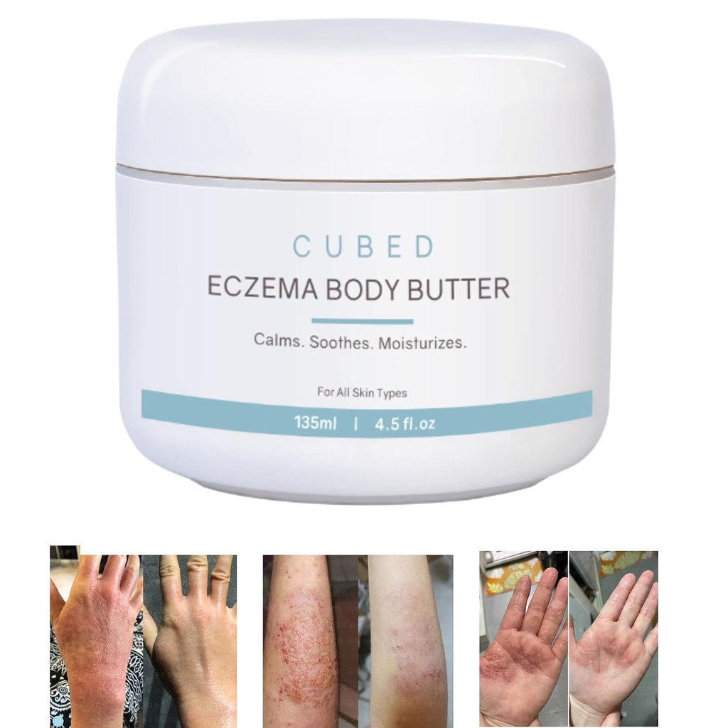 Cubed 4,5 oz Eczema Cream voor volwassenen, Eczema Relief, Eczema Treatment, Moisturize Dry Irridated Skin, Smart Lotion voor Topische Steroïden Ontwenningsverschijnselen, psoriasis & Rosacea, Eczema, Dermatitis