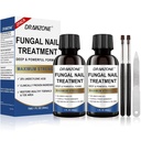 Teennagel Schimmel Behandeling Extra sterkte met 25% Undecyleenzuur, Ingegroeide teennagel behandeling, nagel reparatie, Schimmel nagel behandeling, gele teennagel, Beschadigde Nagels voet schimmel behandeling extra sterkte