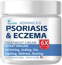 Bio-MD Psoriasis Eczeem Cream, Eczeem Cream voor volwassenen, Extra sterkte controle opnieuw optreden, Relieve Symptoom van Resistent, Effectief voor Seborrheic Dermatitis, Folliculitis behandeling