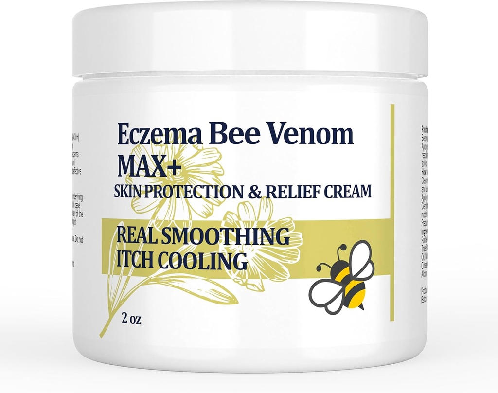 Hoge sterkte Bijen Venom Cream, Dyshidrotisch Eczeem Zalf, Heat Rash, Jeuk, Eczeem, Psoriasis, Been, Maag, Voet, Hand, Geïrriteerde huid, All Age Care