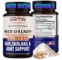 groeien vitamine Multi Collageen Capsules 1800MG (Types I, II, III, V & X) - Niet GGO, Grass Fed Collageen - Anti Aging Ondersteuning voor haar, huid, nagels - Proteïne pillen voor gezamenlijke ondersteuning - 90 capsules