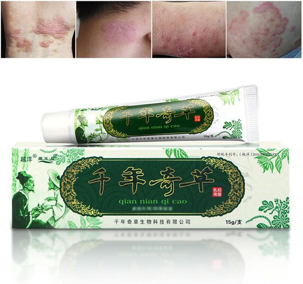 Oversea Duizend-jaar kruiden crème Chinese kruiden eczeem, psoriasis crèmes dermatitis en eczeem Pruritus psoriasis JIULIN Zalf