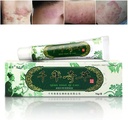 Oversea Duizend-jaar kruiden crème Chinese kruiden eczeem, psoriasis crèmes dermatitis en eczeem Pruritus psoriasis JIULIN Zalf