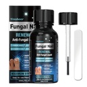 Teennagelschimmel behandeling, Nagelschimmel behandeling voor teennagel, nagel reparatie oplossing, vingernagels vernieuwing vloeistof voor beschadigde & verkleuring Nagel, nagelschimmel behandeling, veilig en voorzichtig - 30ML (1 FLOZ)