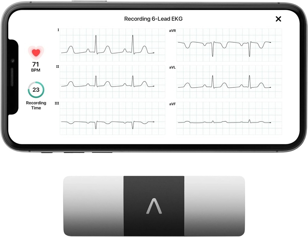AliveCor KardiaMobile 6-Lead Personal ECG Monitor Six Views of The Heart 