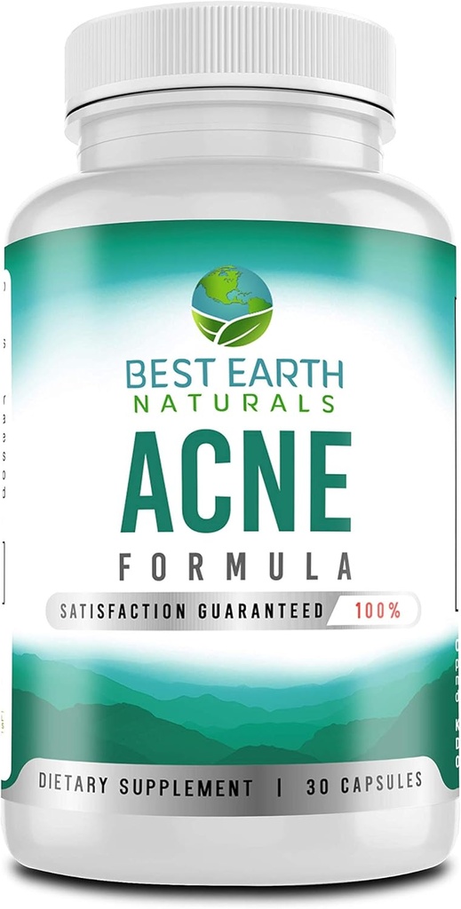 Best Earth Naturals AcneSupplement Formula Vlaamse Blocker helpt het bevorderen van helder, stralend, gezonde huid + vecht vlekken van binnen 30 Tellen