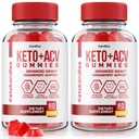 NutraRize (paquet de 2 KetoKandies Keto+ACV) Gummies pour perte de poids, supplément de force maximale, Keto Kandies Commentaires (120 Gummies)