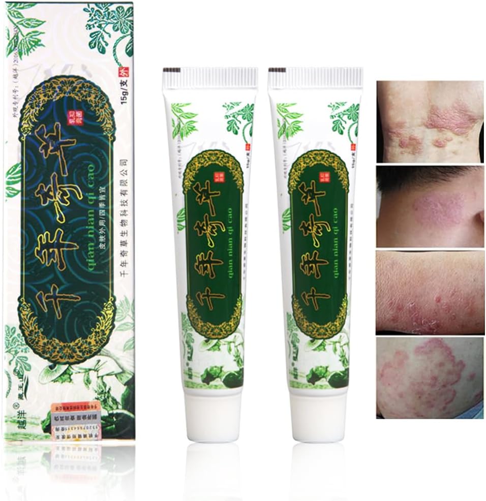 Oversea Duizend-jaar kruiden crème Chinese kruiden eczeem, psoriasis crèmes dermatitis en eczeem Pruritus psoriasis JIULIN zalf (2PCS)