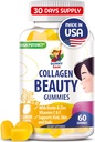 SUNNY SAM Gommies de collagène Biotine pour les femmes et les filles - Sucre faible 60 Gommies de collagène de beauté à croquer pour peau et ongles de cheveux améliorés - Biotine, vitamine A, supplément de zinc - Saveur de citron naturel