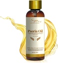Siya Ayurveda Psoriasis Treatment Oil for Natural Relief 