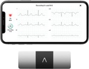 AliveCor KardiaMobile 6-Lead Personal ECG Monitor Six Views of The Heart 